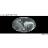 digitalTRAFFIC foetus album cover image